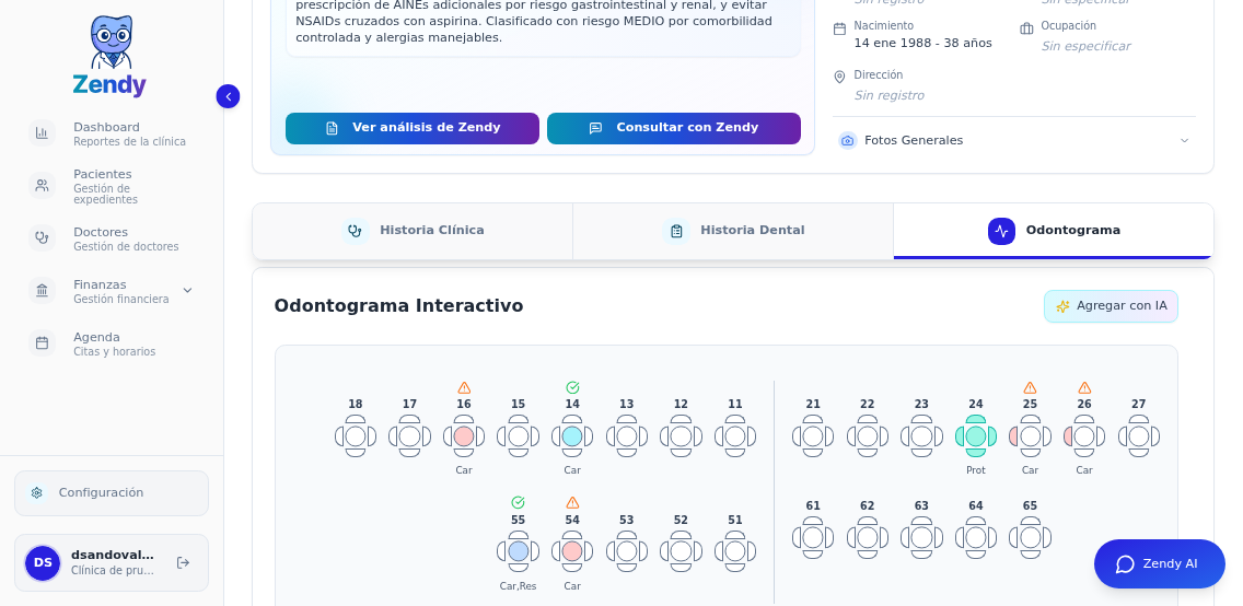 Odontograma con diagnósticos marcados en varios dientes