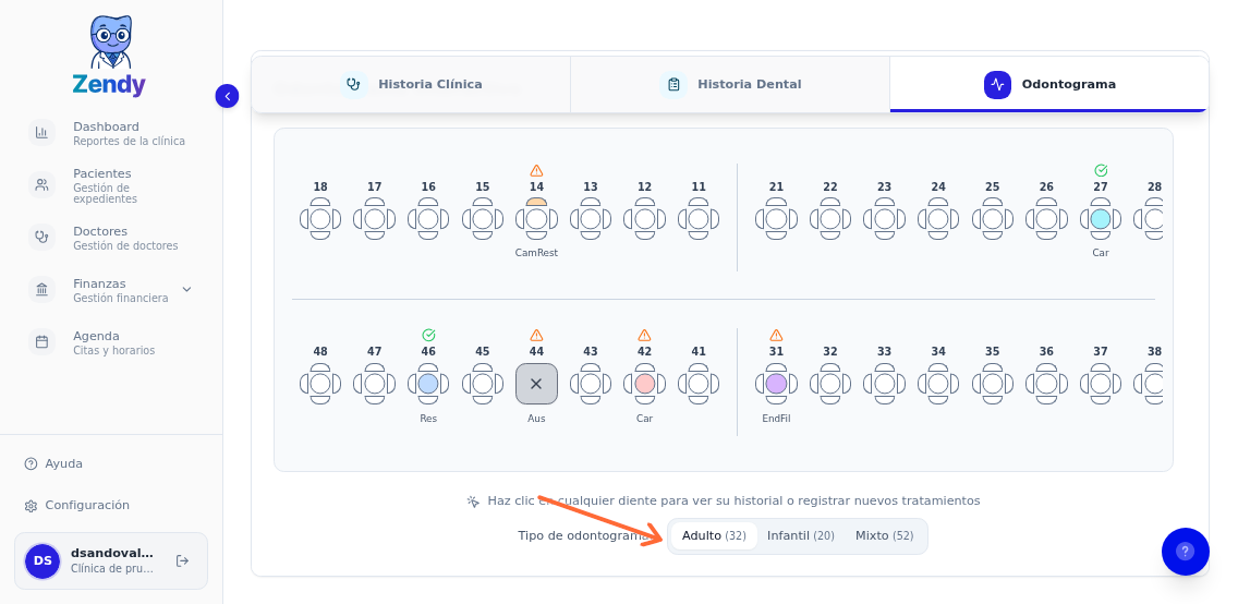 Botones para seleccionar tipo de odontograma: Adulto, Infantil, Mixto y Auto
