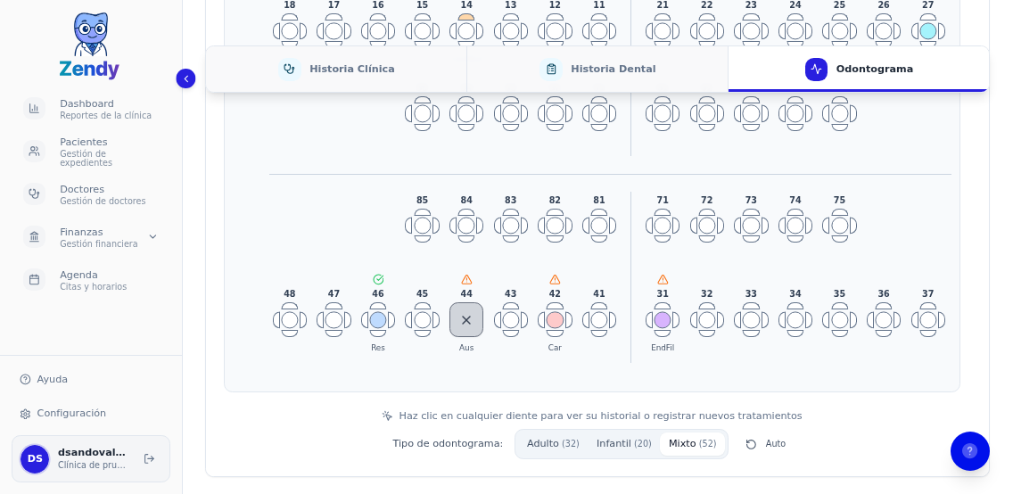 Popover mostrando la opción Marcar listo para un diente