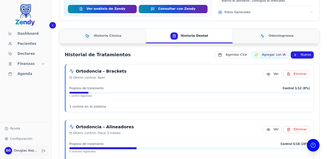 Control de ortodoncia con fotos documentando la evolución del tratamiento