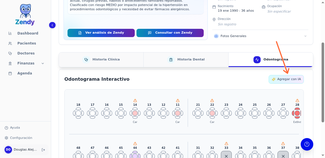 Botón Agregar con IA en el odontograma