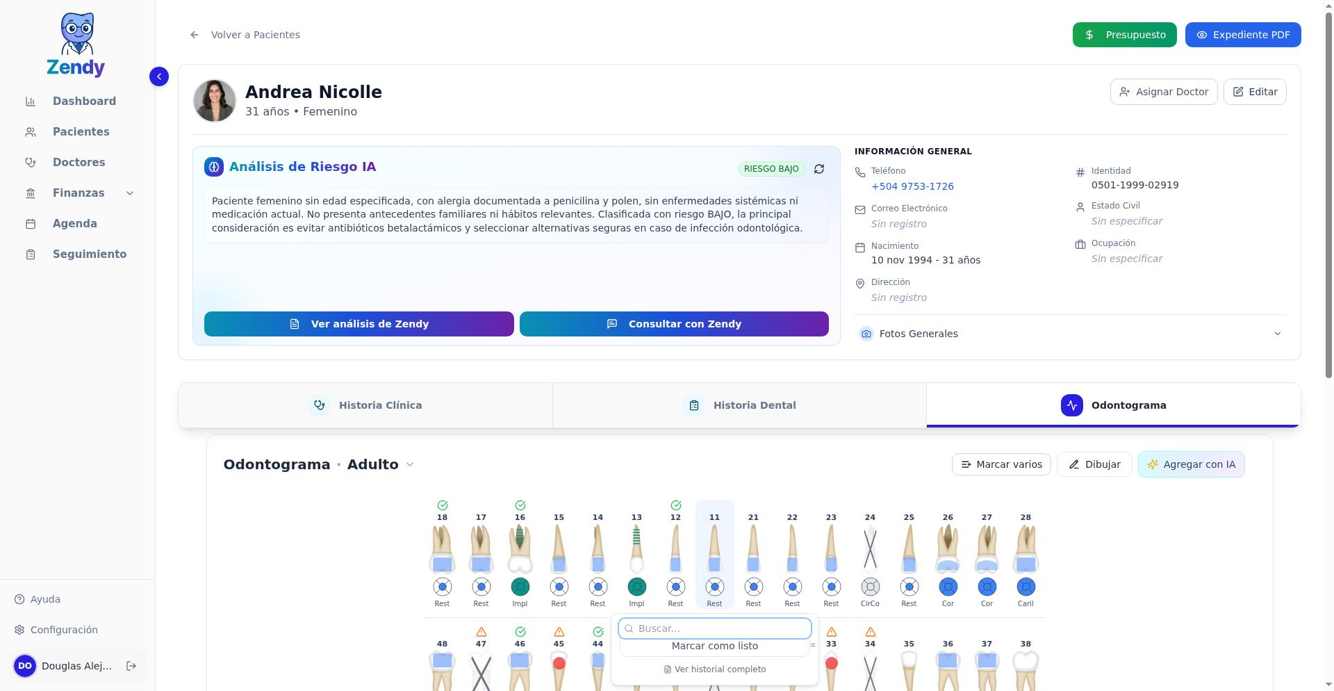 Selector de caras con preview del indicador