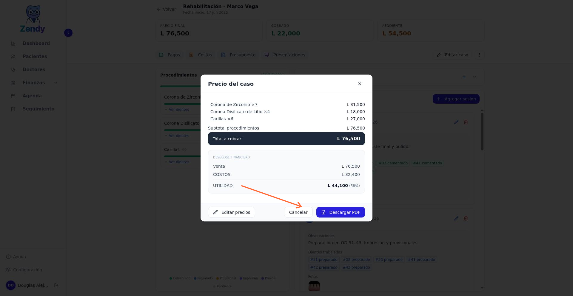 Modal de presupuesto con toggles de configuración